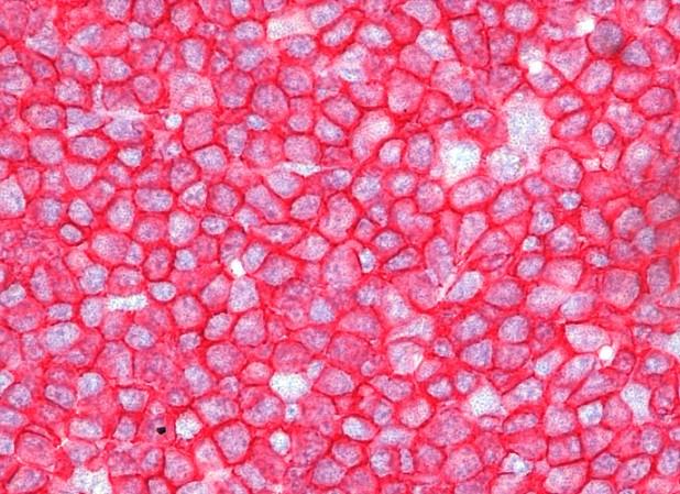 AP-Red Solution Set IHC 2 components AP-Red Solution Set IHC: 2 components red chromogen for alkaline phosphatase optimized for immunohistochemical procedures Immunohistochemical Cytokeratin 5/6