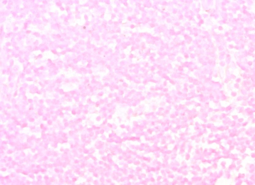 Nuclear Red Solution Ready-to-use Nuclear Red Solution : optimized for in situ hybridization (ISH) and immunohistochemical (IHC) procedures no dilution required prior to use optimized to avoid