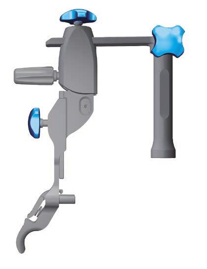Appendix C: Tibial I.M. Jig Alignment The handle is removed and the I.M. rotation guide is placed over the I.M. rod to define the correct rotational tibia axis, referring to the condylar axis, medial 1/3 of the tibia tubercle and the centre of the ankle (Figure 85).