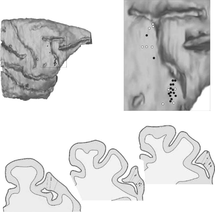 Figure 7. (A) Lateral view of the 3-D reconstruction of the right hemisphere of Monkey 1.