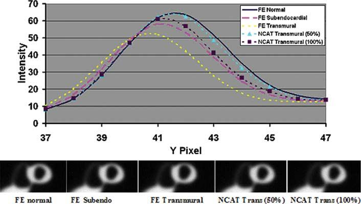 1614 IEEE TRANSACTIONS ON MEDICAL IMAGING, VOL. 25, NO. 12, DECEMBER 2006 Fig. 13.