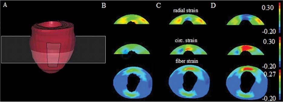 1610 IEEE TRANSACTIONS ON MEDICAL IMAGING, VOL. 25, NO. 12, DECEMBER 2006 Fig. 8. Comparison of strains predicted by FE models for the mid-ventricular cross-section.