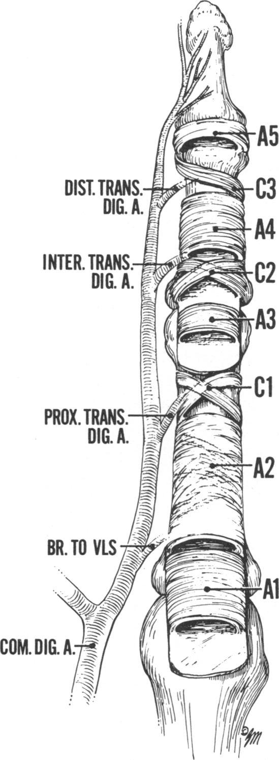 186 MARILYN M. JONES AND A. A. AMIS Fig. 1. The individual pulleys of the fibrous flexor sheath.