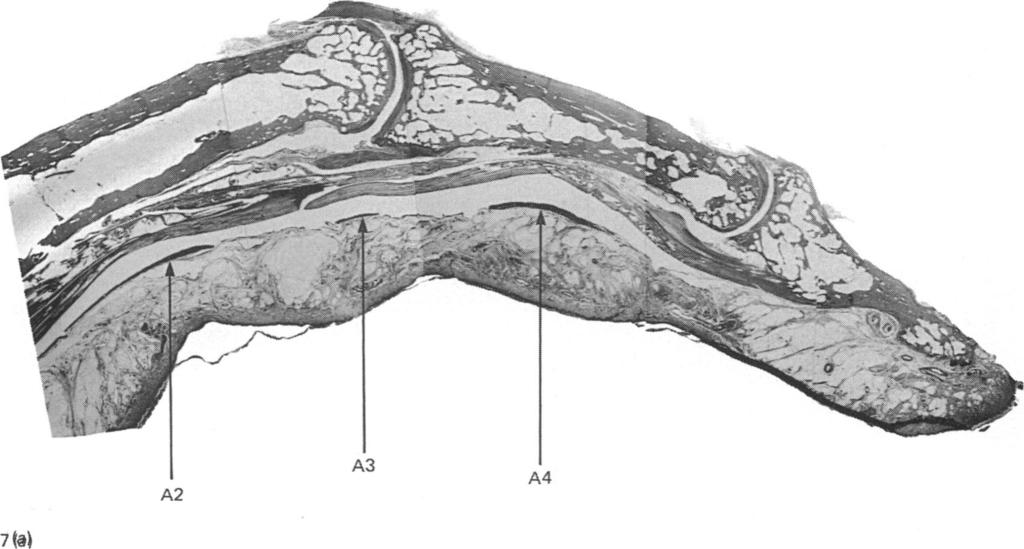 192 MARILYN M. JONES AND A. A. AMIS 7 t4 Fig. 7(a-d). (a) Sagittal section of a finger showing the dense A2, A3 and A4 pulleys with the thin sheath between them and distal to A4.