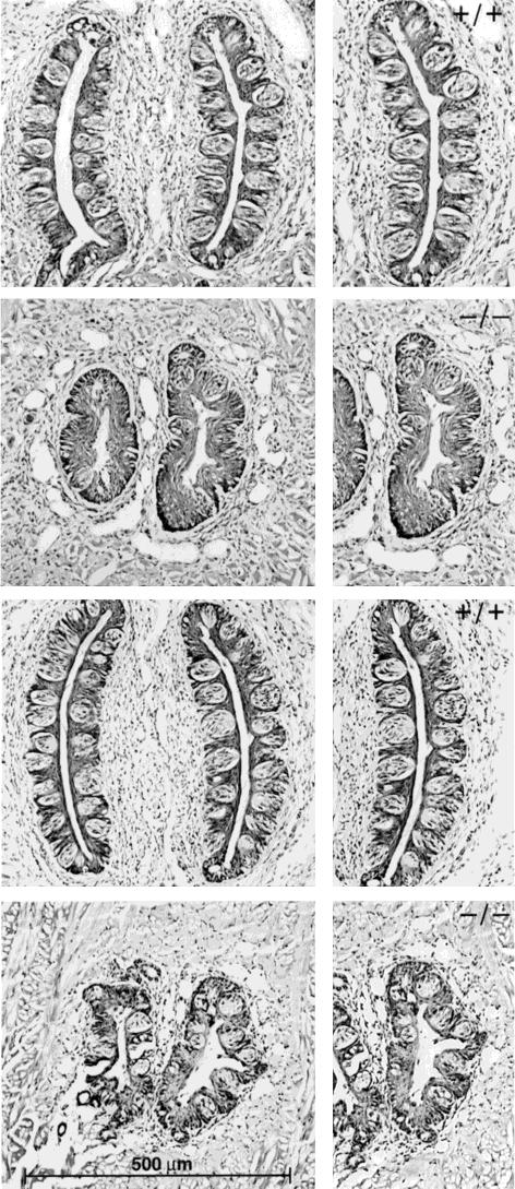 Fig. 5. Photomicrographs of the circumvallate papilla and taste buds from / and / tongues at postnatal day (P) 15 (top) and P25 (bottom).