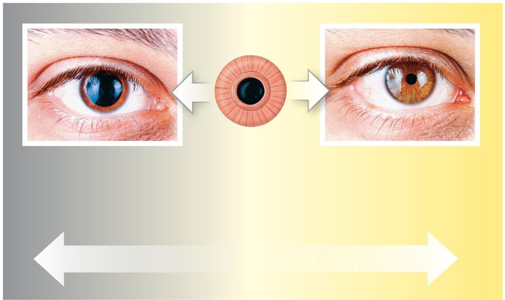 Figure 17-6 The Pupillary Muscles Pupillary constrictor (sphincter) Pupil The pupillary dilator muscles extend radially away from the edge of the pupil.