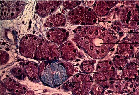 HUMAN SUBMANDIBULAR GLAND ACINI (rounded sacs): contained in gland at end of ducts. EPITHELIUM of ACINI: FLOOR of MOUTH NEAR LOWER JAW SEROUS CELLS- watery fluid + AMALASE (vs.