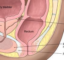 Anatomy of Rectum canal peritoneal reflexion
