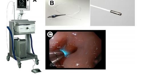 endomicroscopy (pcle) Confocal Laser