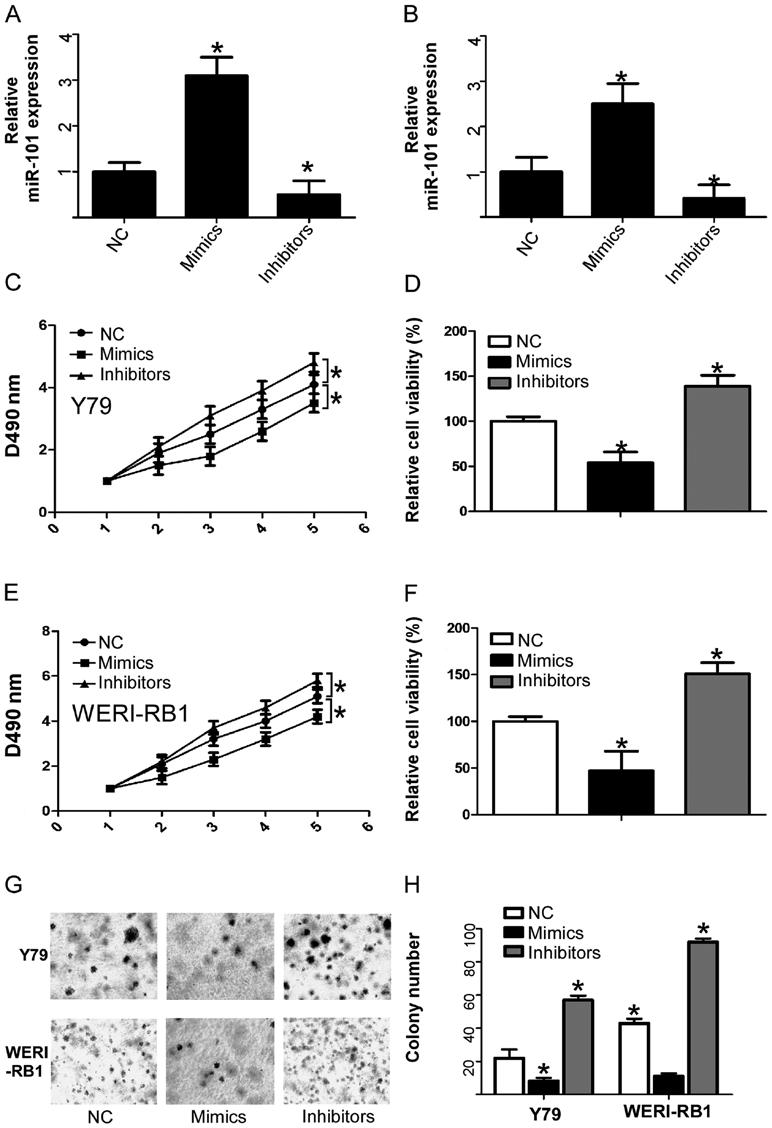 266 LEI et al: THE ROLE OF mir-101 IN RETINOBLASTOMA Figure 3. Associations between mir-101 expression and cell viability and cell proliferation of retinoblastoma cell lines.