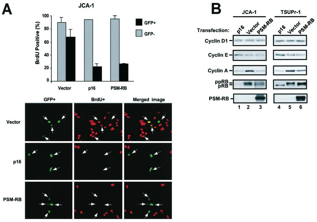 364 RB Regulates the Androgen Requirement Fig. 2. Androgen-independent cells arrested by PSM-RB mimic that of androgen-dependent cells deprived of androgen.