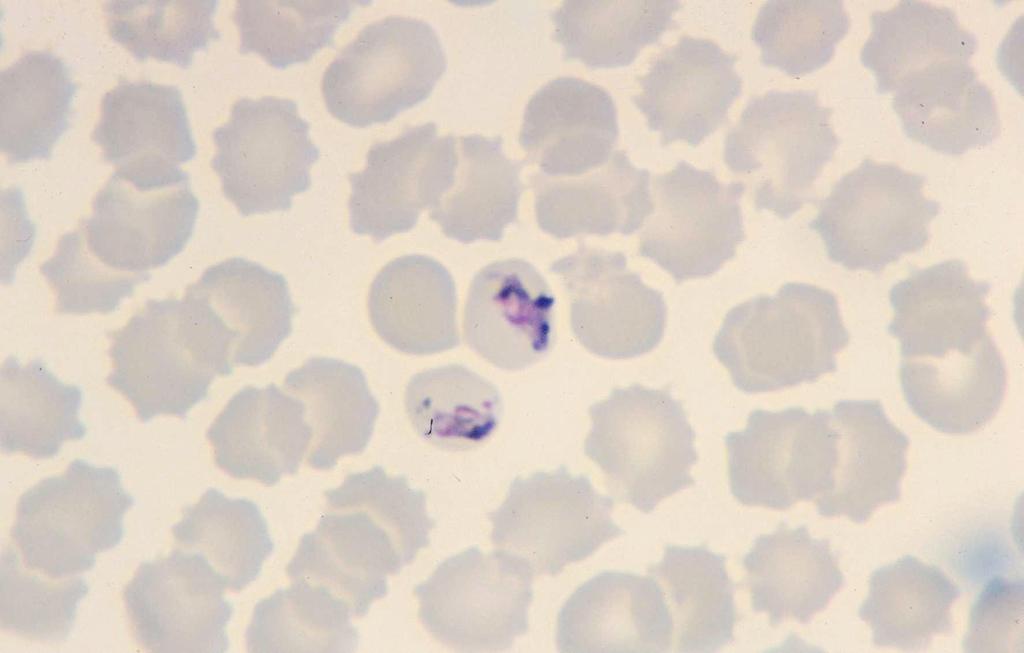 Plasmodium malariae: young