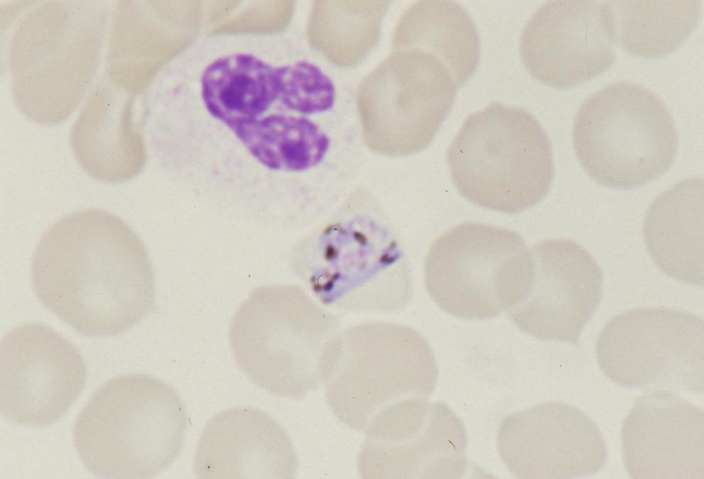 Plasmodium malariae: