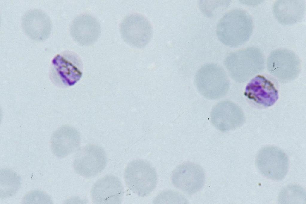 Plasmodium malariae: band