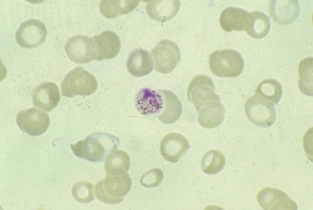 Plasmodium malariae: