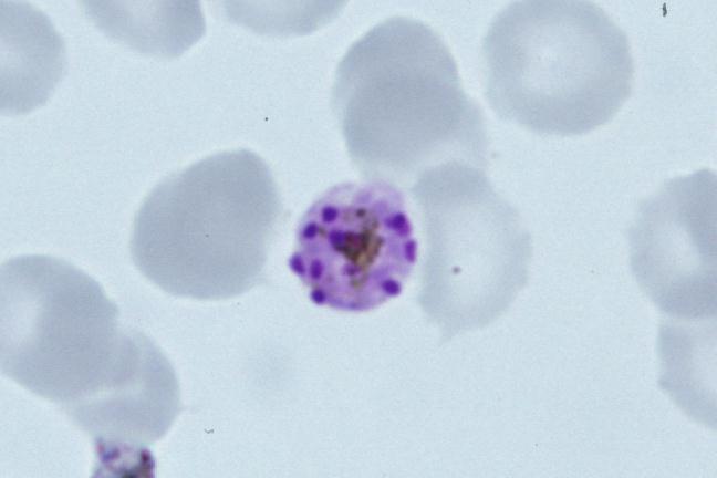 Plasmodium malariae: mature schizont in