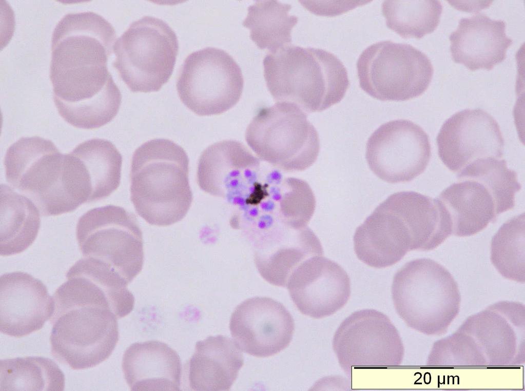 Plasmodium malariae: mature