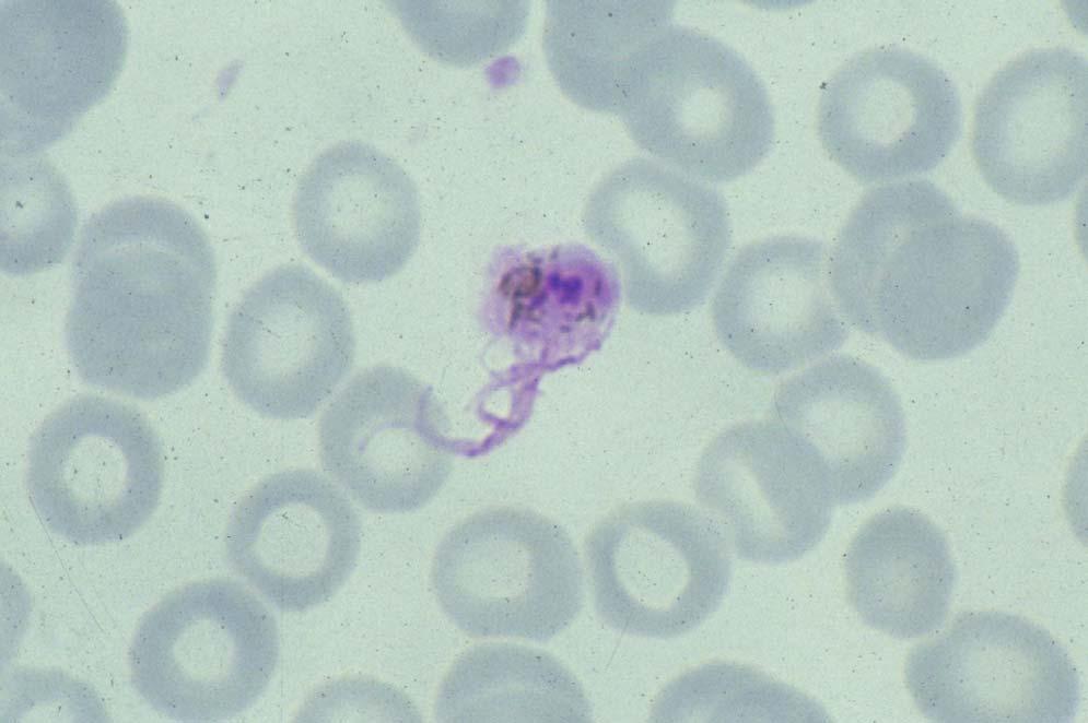 Plasmodium falciparum: in older blood