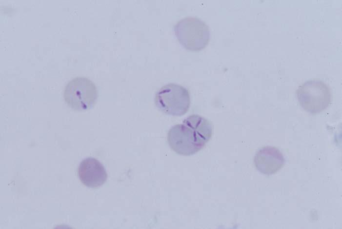 Babesia divergens (thin film). In the US ticks transmit Borrelia spp., Ehrlichia spp., and 
