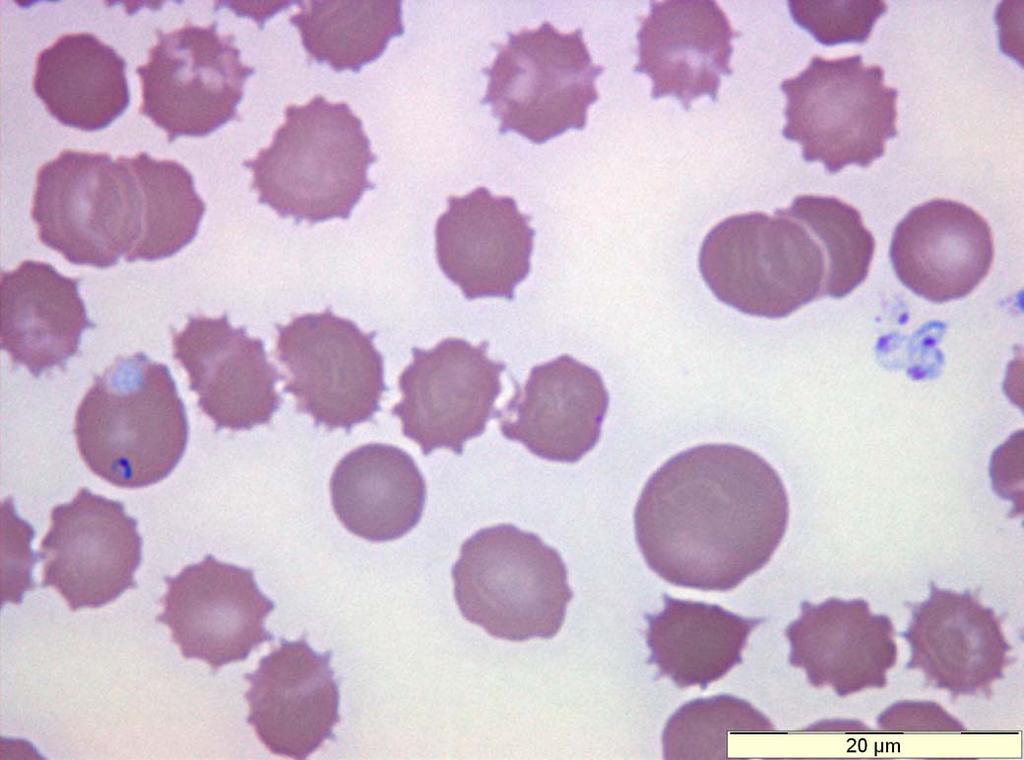 Babesia microti: extracellular