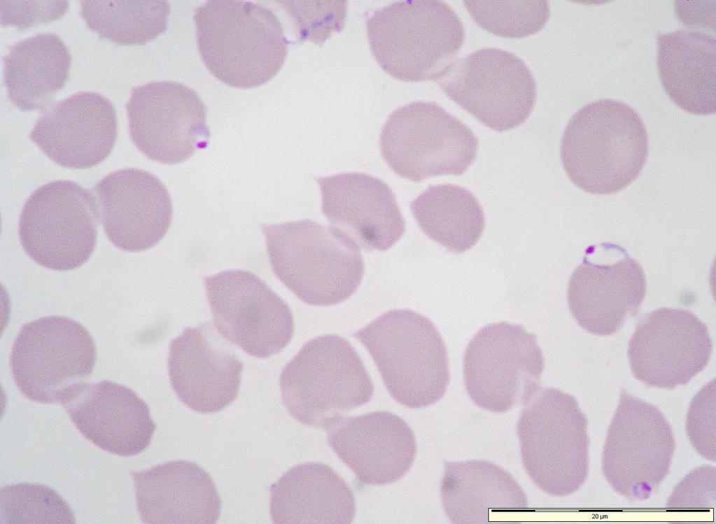 Plasmodium falciparum: two small, and