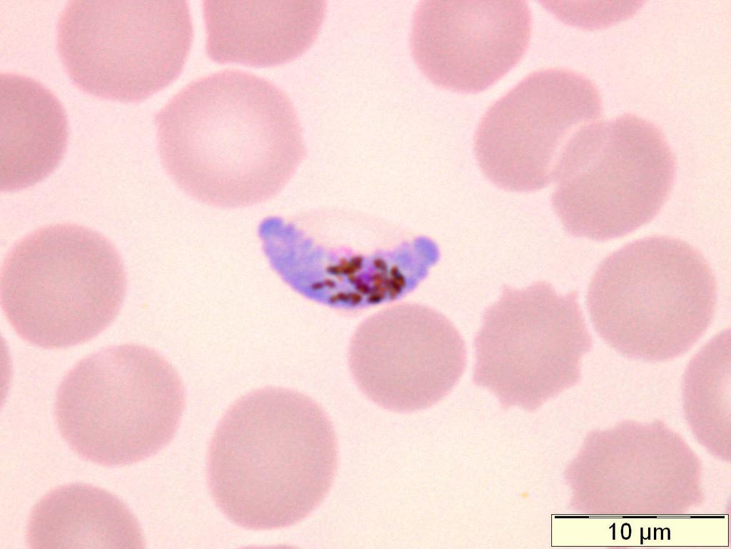 Plasmodium falciparum: one crescentic gametocyte, about