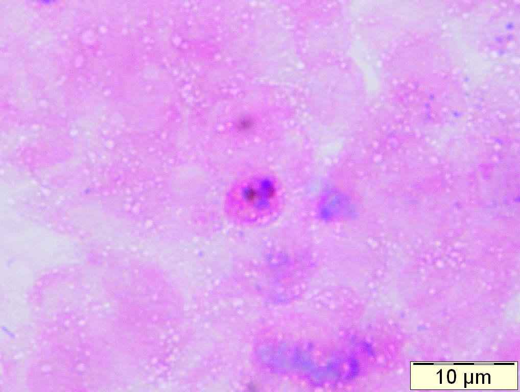 Plasmodium vivax: trophozoite with