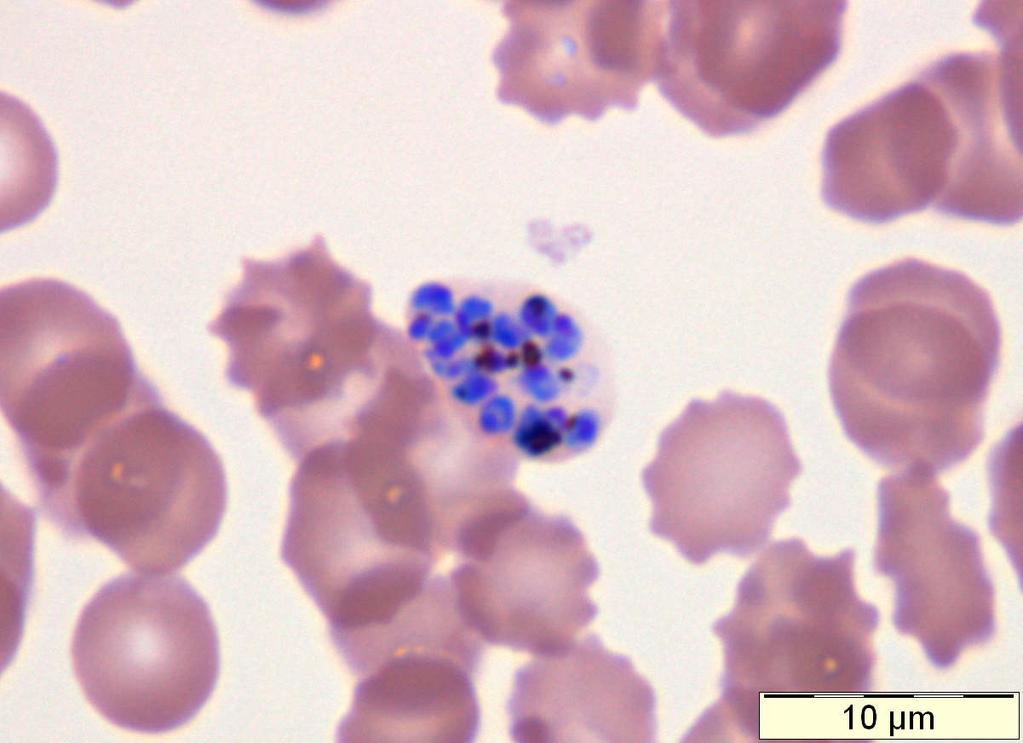 Plasmodium vivax: schizont with many