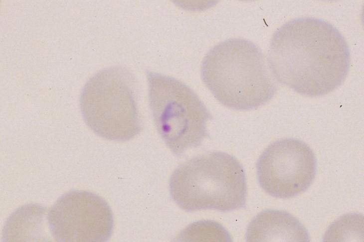 Plasmodium ovale: ring in a
