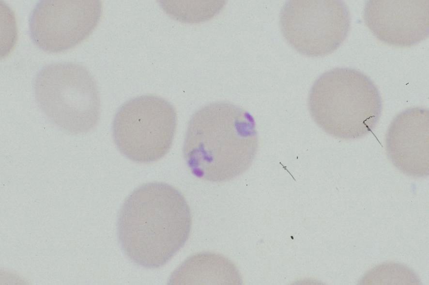 Plasmodium ovale: two