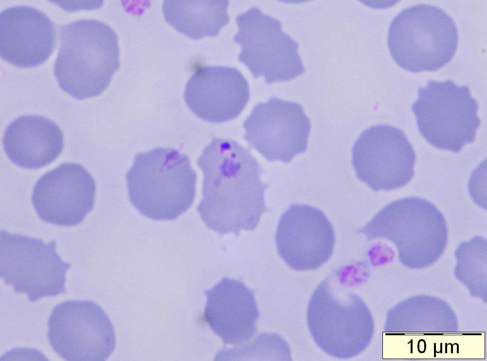 Plasmodium ovale: fimbriated and enlarged oval