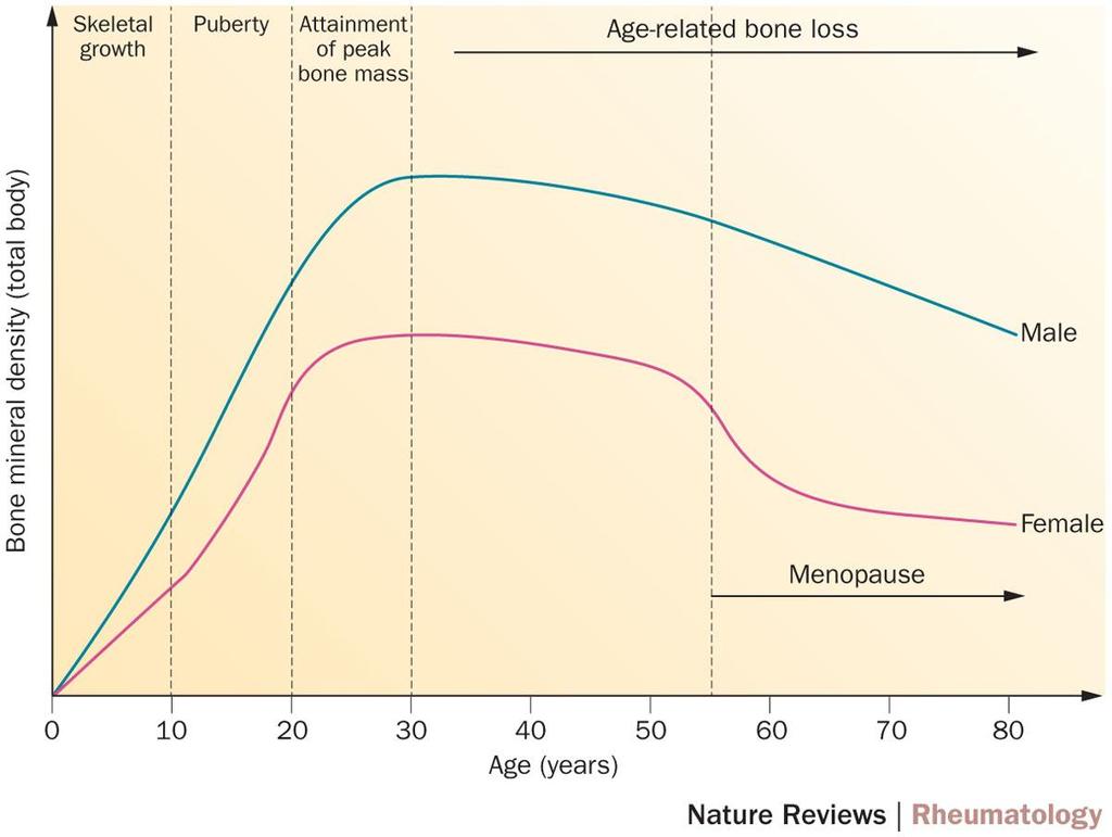 Figure 1 Overview of BMD values during life, indicating the importance of peak bone mass and the subsequent rate of decline in BMD in the development of primary