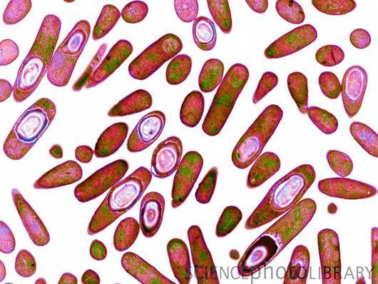 C. difficile Microbiology Gram positive spore forming bacillus (rods) Obligate anaerobe Part of the GI Flora in 1-3% of healthy adult 70% of children < 12