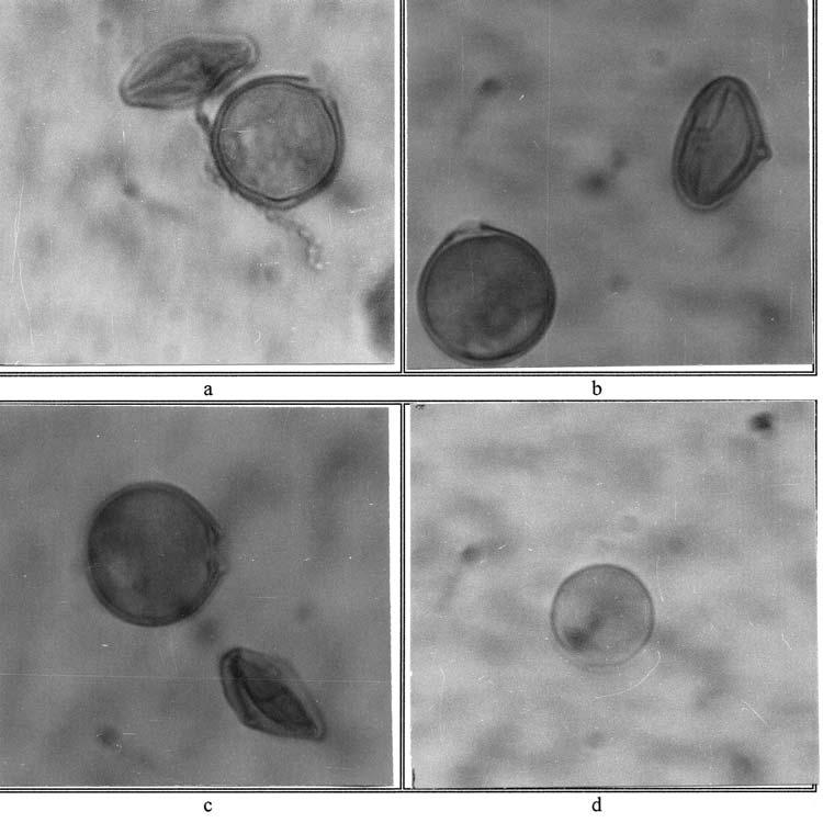 28 N. TORT ET AL., Fig. 2. Sterile pollen types in fungicide application groups a) Switch 60 g/100 L group, wrinkled sterile pollen (6.