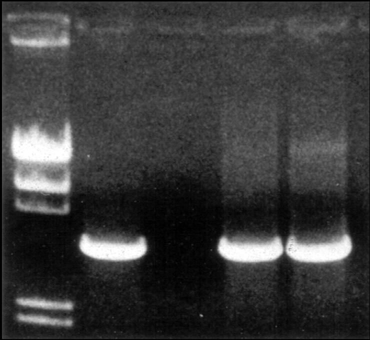 FH-I - Long PCR NORMAL FH-I 23.1 9.4 6.4 4.4 2.3 2.