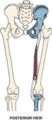 superior iliac spine I: tibial tuberosity I: medial proximal tibial shaft (at pes anserinus) 21 22 Hamstrings