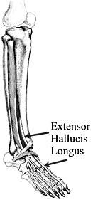 c) Peroneus Tertius Distal 1/3 of anterior fibular and interosseus membrane. ii) Insertion: Dorsal base of the 5 th metatarsal. (1) Dorsiflexion of ankle. (2) Eversion of the foot.