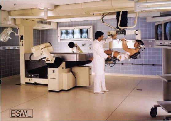 Young therapy method 1980 the first patient with a kidney stone was treated in Munich with a prototype machine
