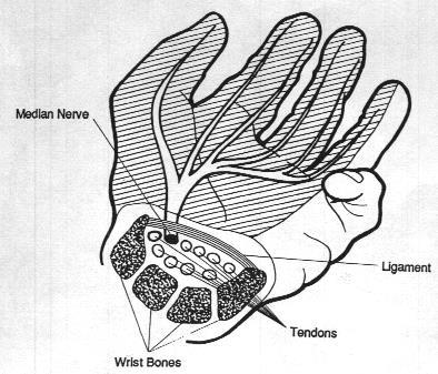 Carpal Tunnel Syndrome SYMPTOMS tingling/numbness reduced grip