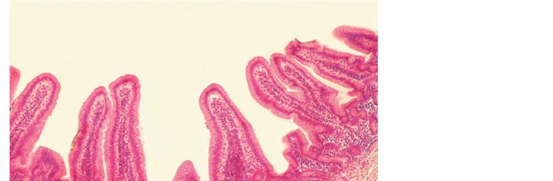 Histology of the Alimentary Canal Mucosa Submucosa Muscularis externa Serosa (b) Light micrograph