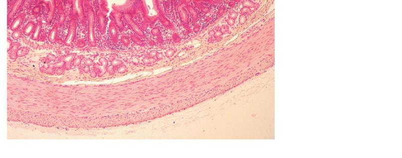 7b Smooth Muscle Longitudinal layer of smooth muscle (shows smooth muscle fibers in cross section,