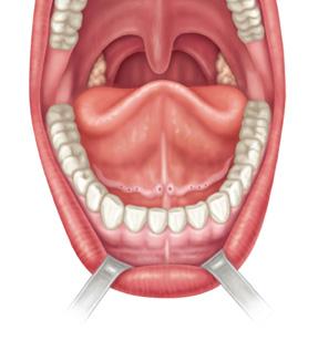 arch Posterior wall of oropharynx Tongue Lingual frenulum Opening of submandibular duct Gingivae (gums) Inferior