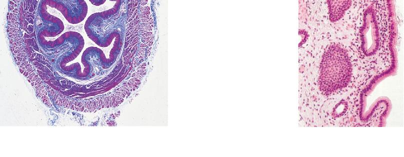 epithelium) Submucosa (areolar connective tissue) Lumen Muscularis externa Circular layer Longitudinal layer