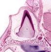 Locate the taste buds on the lateral wall of the papilla. TOOTH DEVELOPMENT (Slides GI 5, GI 6) Slide GI 5 contains a developing tooth. At what stage of development is it (bud, cap, bell)?