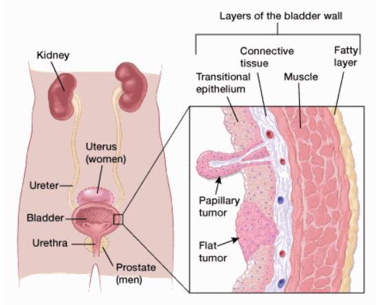 Anatomy of Bladder Wall Sources: http://www.cancer.org and http://topmedicaljournals.