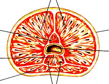 Prostate Anatomy Lateral lobes Anterior lobe Median