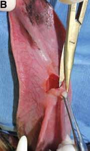 Figure 8 excision.