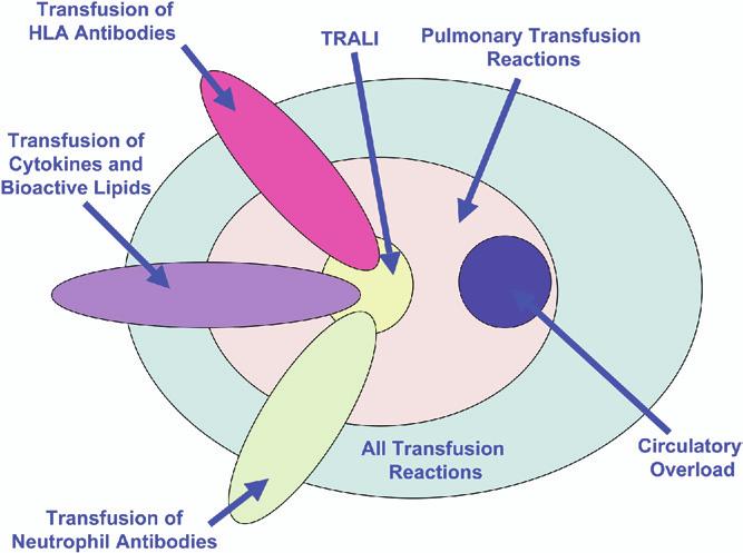 12 D.F. Stroncek Conclusions Transfusion reactions are common, and pulmonary reactions represent one of the more serious types of transfusion reaction.