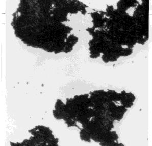 The agglutination reaction reveals the presence of the A antigen on the immune globulin (RhIG) or Rhogam. These passively acquired antibodies surface of the cells.