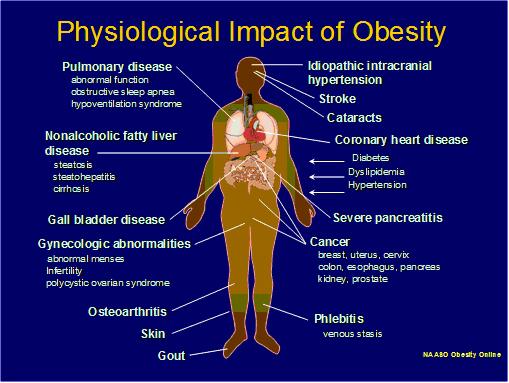 Obesity: Co-existing Clinical Complications With this heavier workforce, clinically in PT practice we tend to also see and need to address these diseases and complications: 80% of type II diabetes